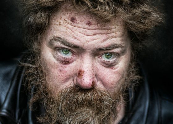 Solving the Homeless Crisis